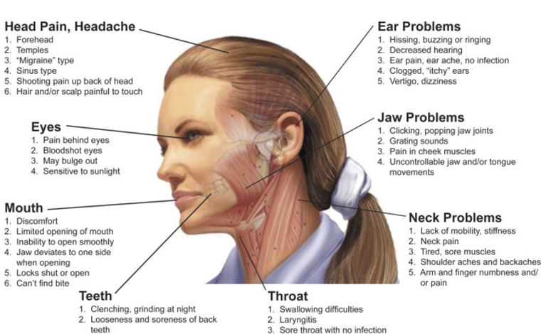 TMJ Headaches