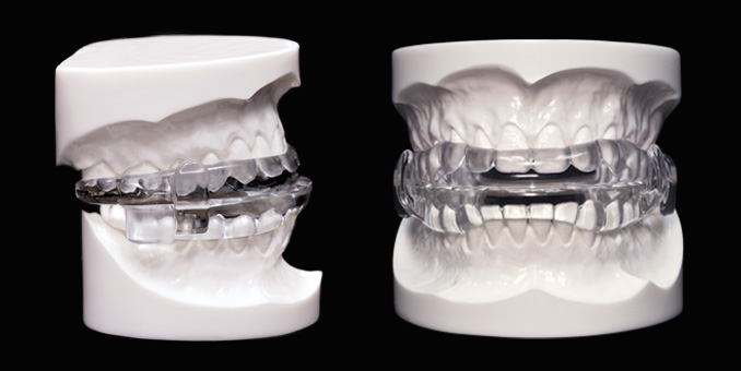 The MicrO2 Sleep Apnea Device (image via microdental.com)