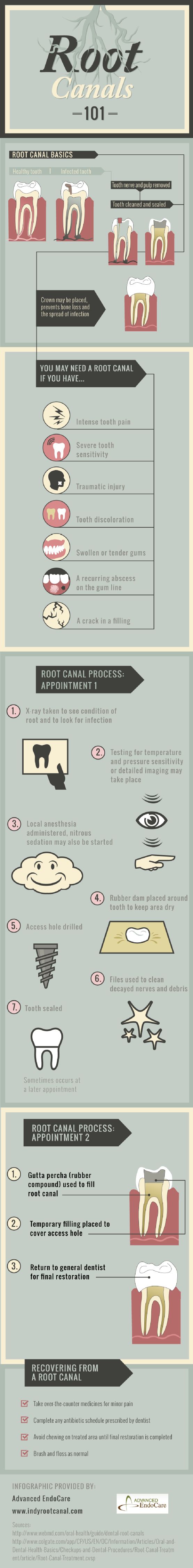  Intense tooth pain, sensitivity, and discoloration could be signs that you have a root canal!