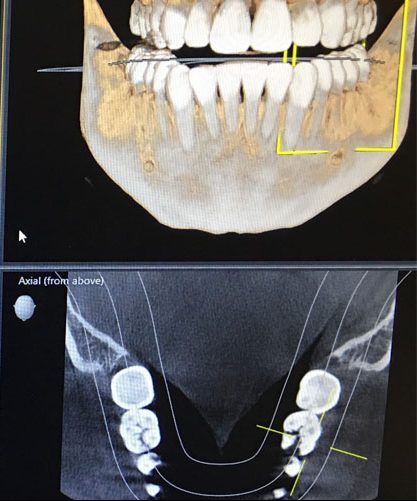 Advanced Imaging