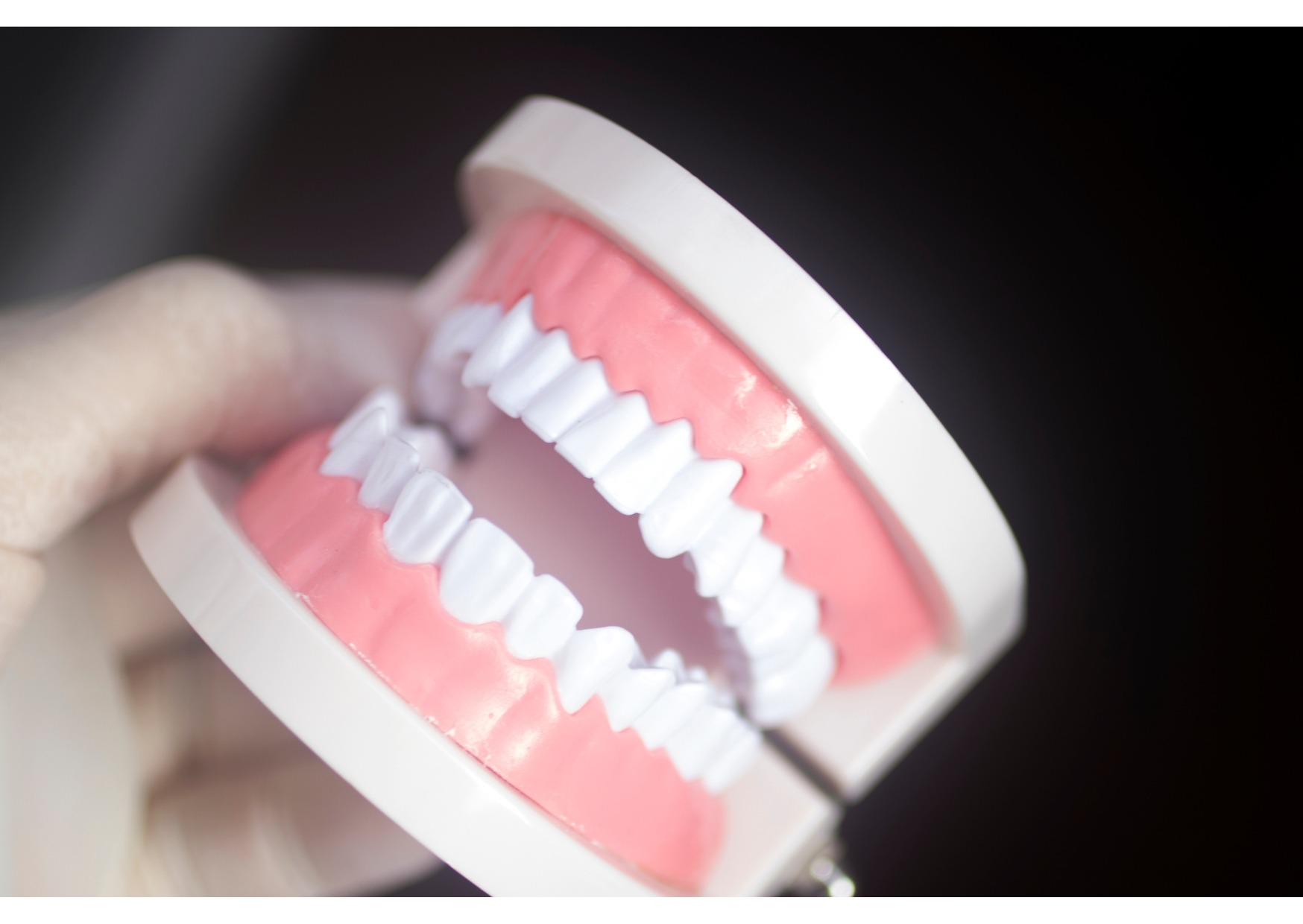 Dental model used to compare cosmetic results when choosing bonding or veneers